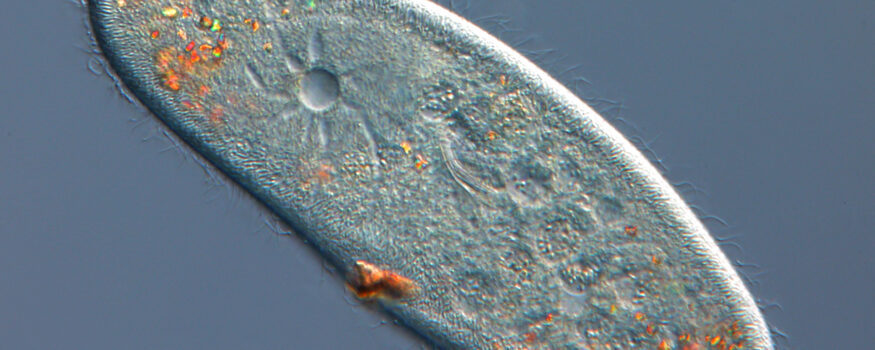 A close-up image of paramecium caudatum