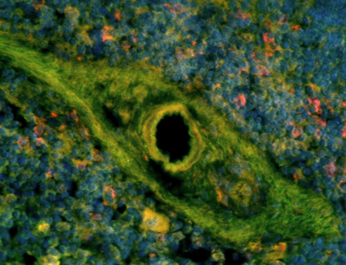 A mouse spleen imaged with widefield microscopy.