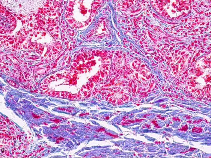 Pathology