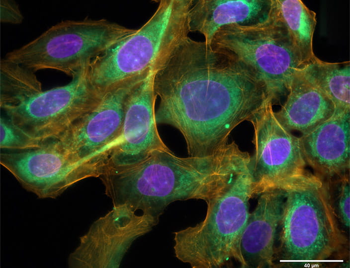 Mikroskopiesysteme und Komponenten für die Fluoreszenzbildgebung